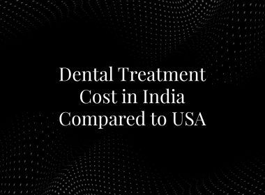 Dental Treatment Cost in India Compared to USA