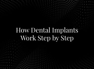 How Dental Implants Work Step by Step