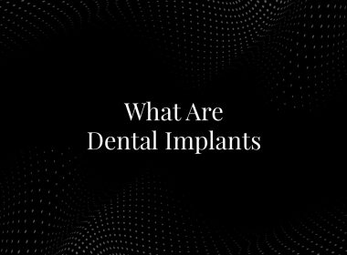 What Are Dental Implants