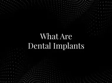 What Are Dental Implants