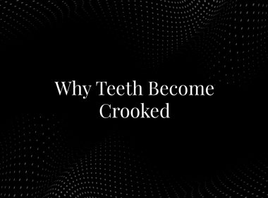 Why Teeth Become Crooked