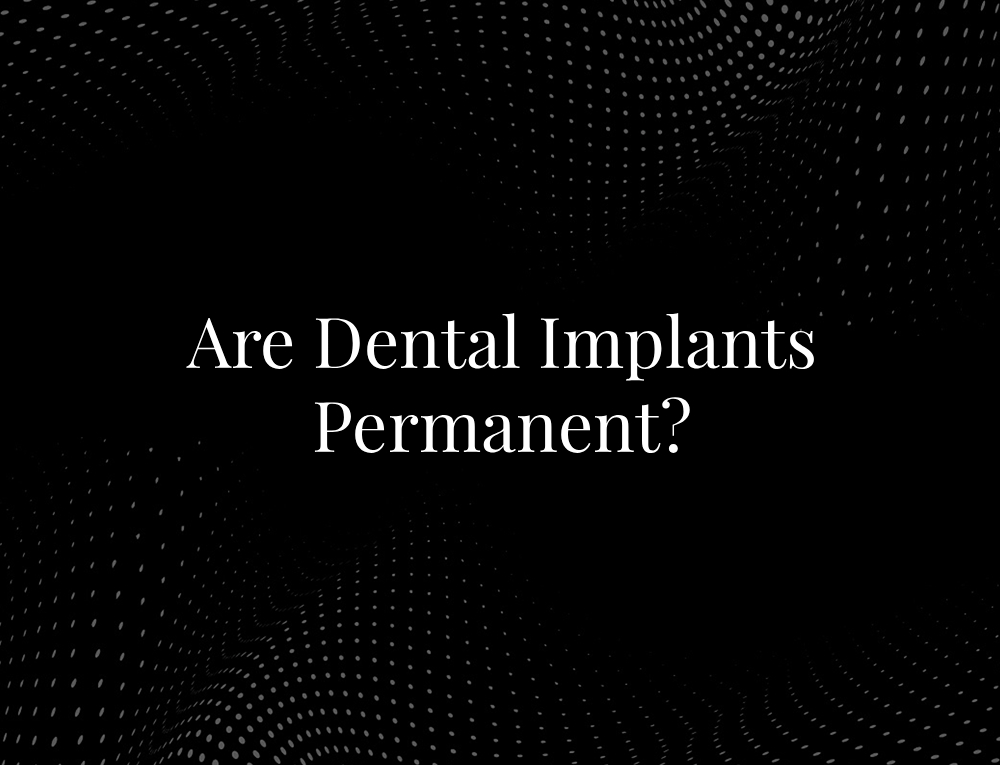 Are Dental Implants Permanent?