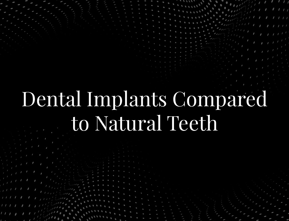 Dental Implants Compared to Natural Teeth