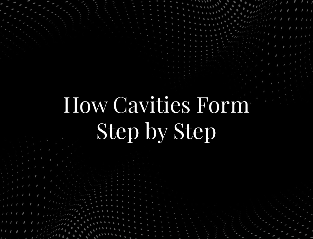 How Cavities Form Step by Step