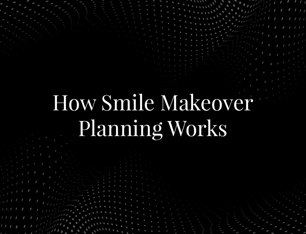 How Smile Makeover Planning Works