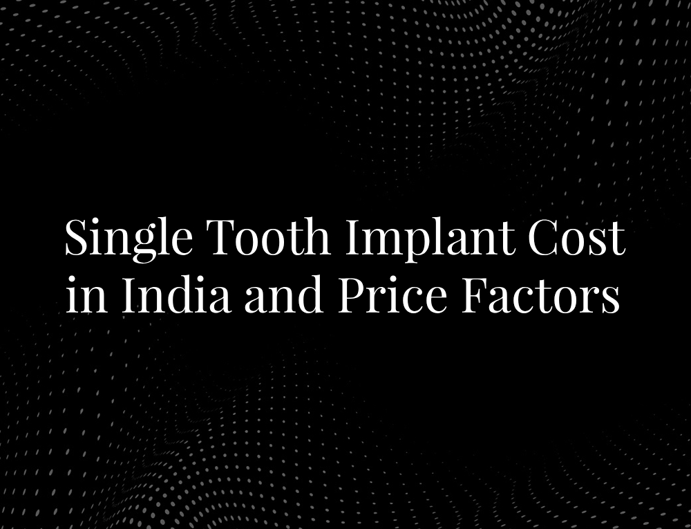 Single Tooth Implant Cost in India and Price Factors