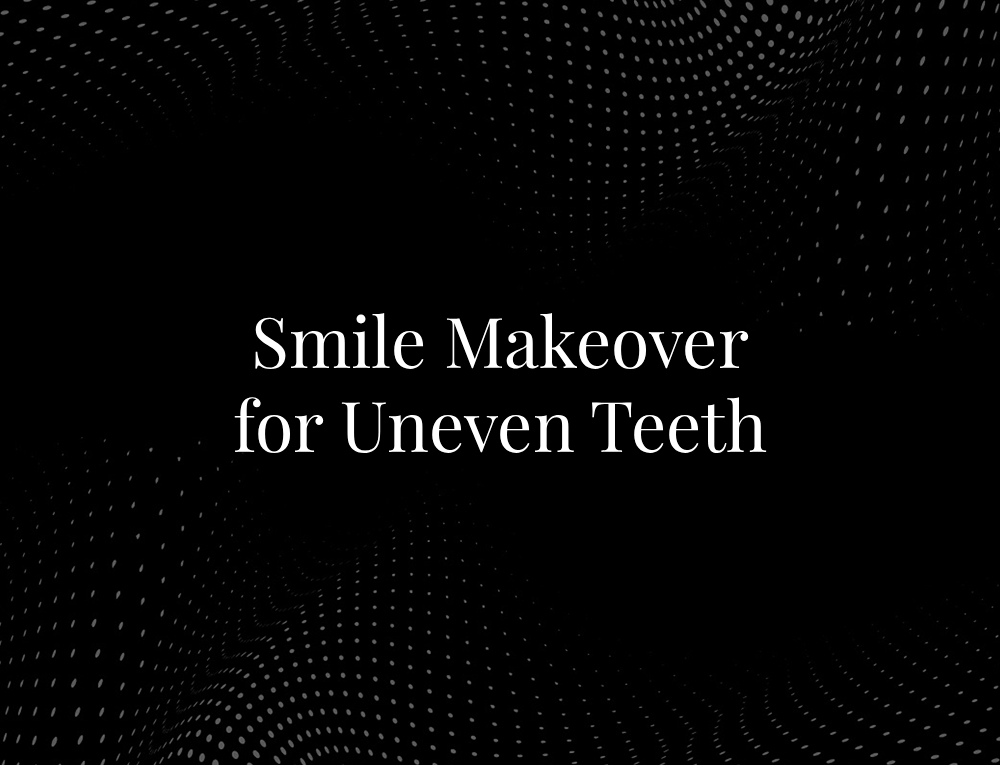 Smile Makeover for Uneven Teeth