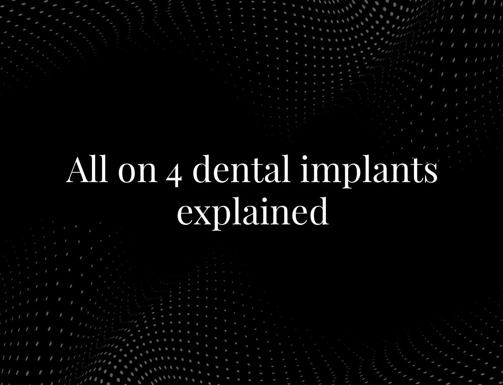 All on 4 dental implants explained