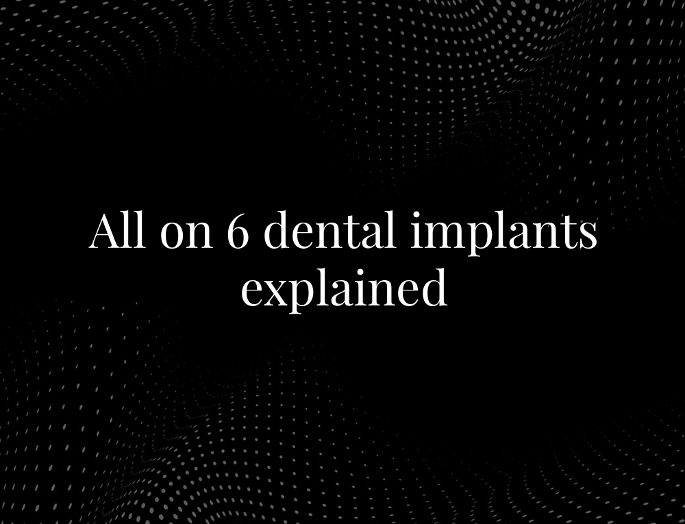 All on 6 dental implants explained
