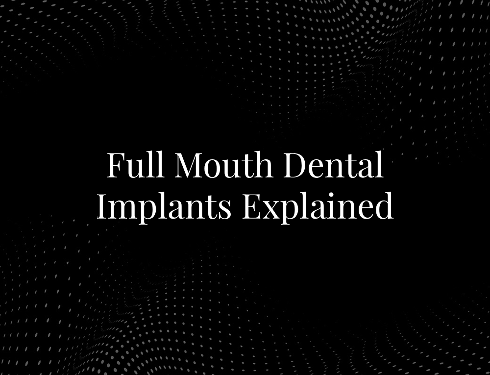 Full Mouth Dental Implants Explained