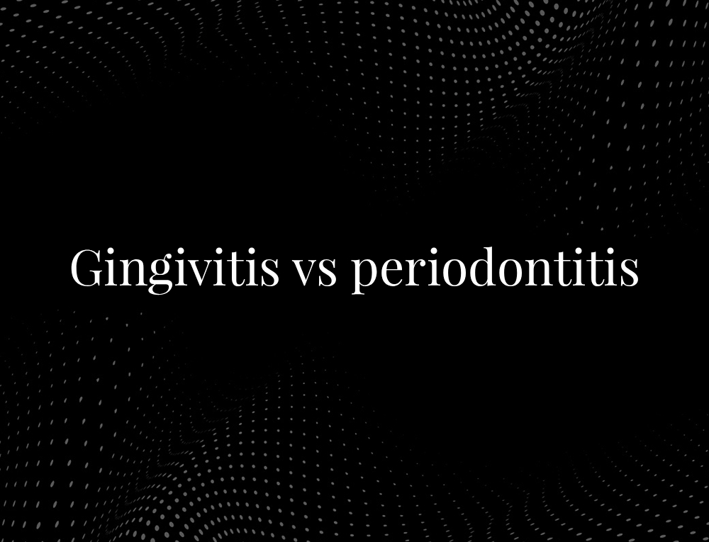 Gingivitis vs periodontitis