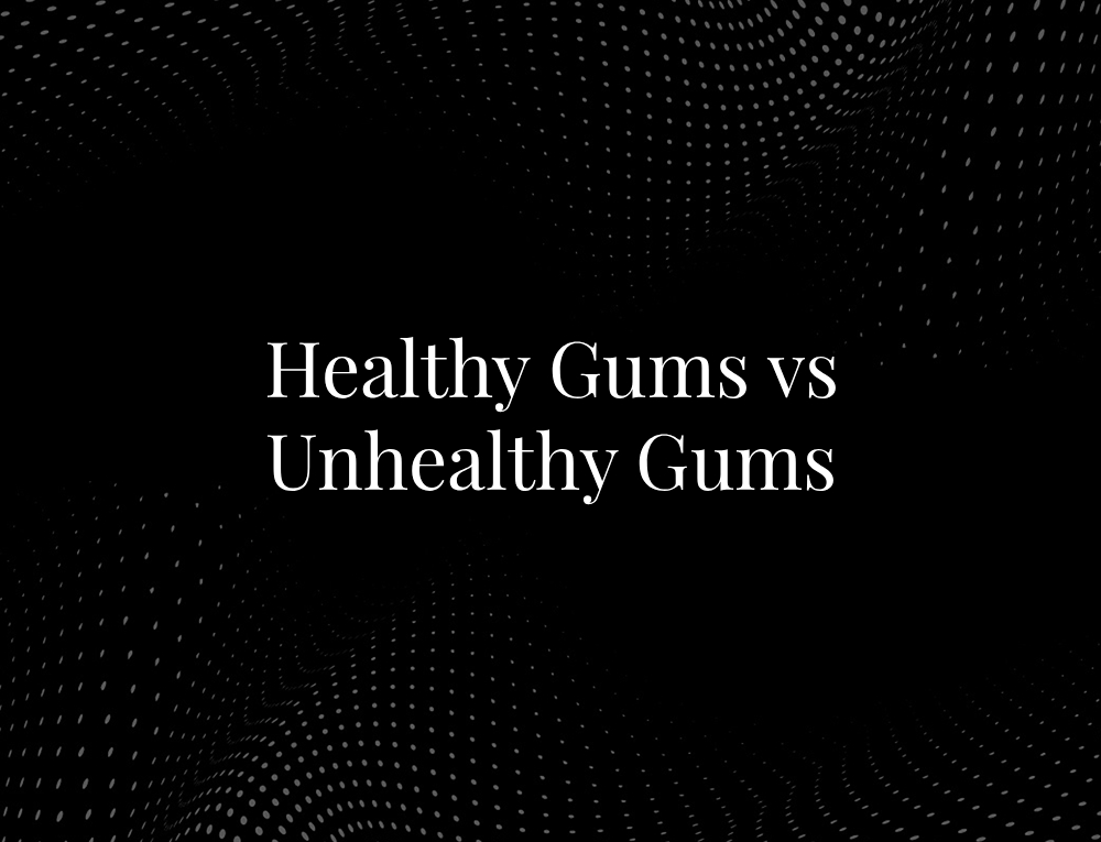 Healthy Gums vs Unhealthy Gums