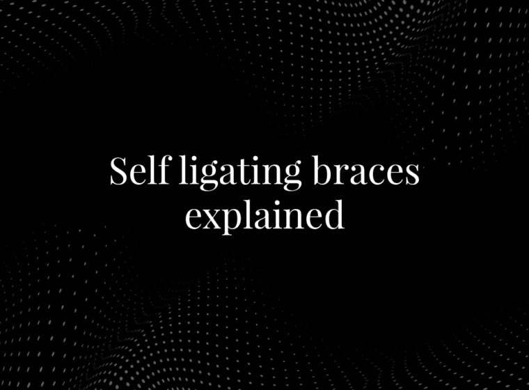 Self Ligating Braces Explained