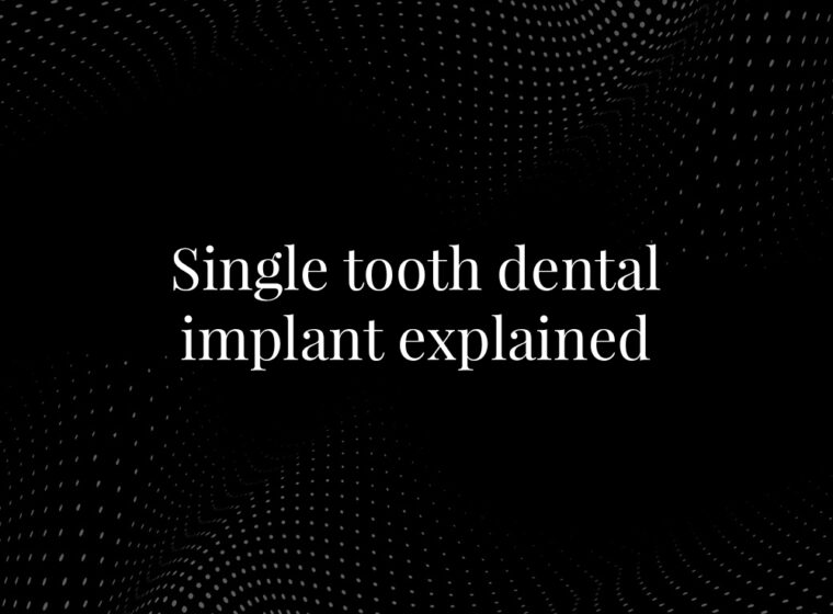 Single Tooth Dental Implant Explained
