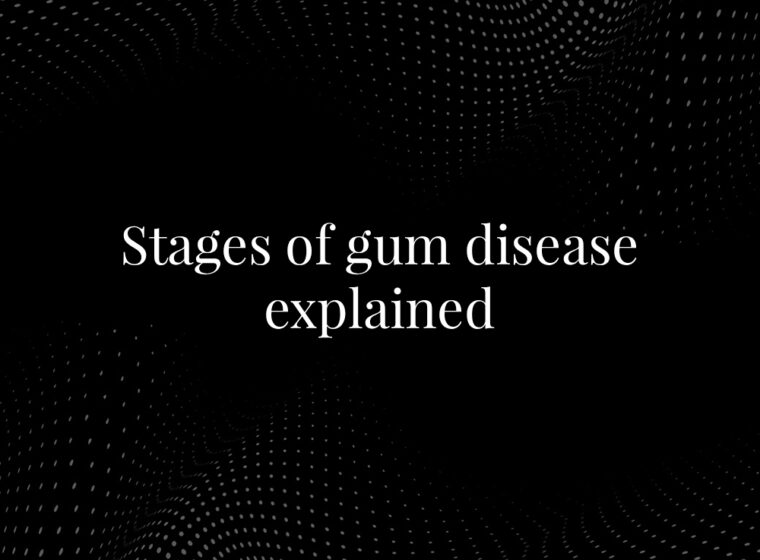 Stages of Gum Disease Explained