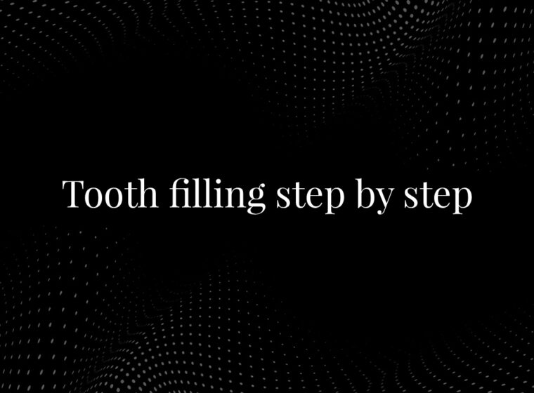Tooth Filling Step by Step: A Complete Guide to the Tooth Filling Procedure