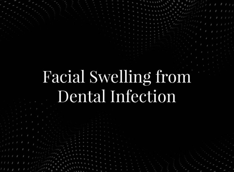 Facial Swelling from Dental Infection