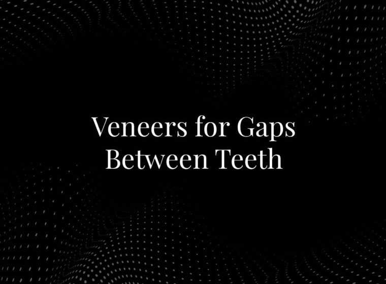 Veneers for Gaps Between Teeth