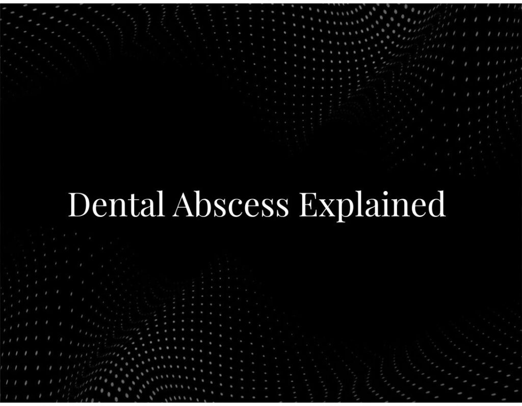Dental abscess infection tooth diagram