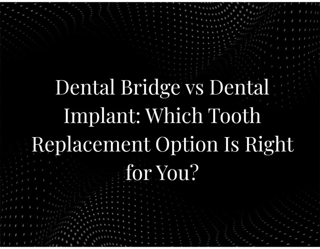 Dental bridge vs implant comparison