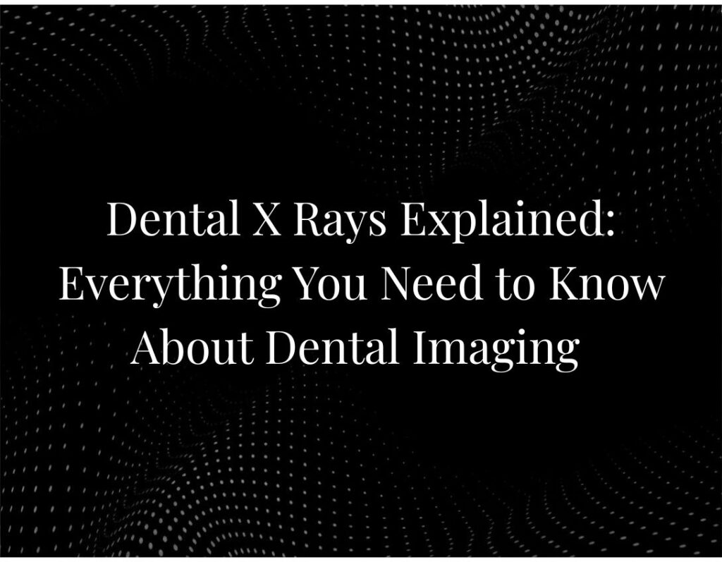 Dental X-ray imaging explained diagram