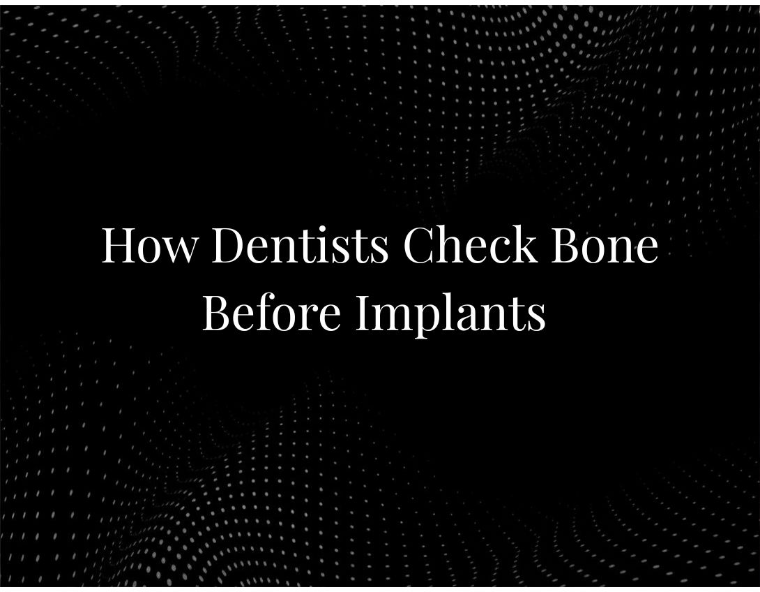 How Dentists Evaluate Bone Before Placing Implants | Dentzz Dental
