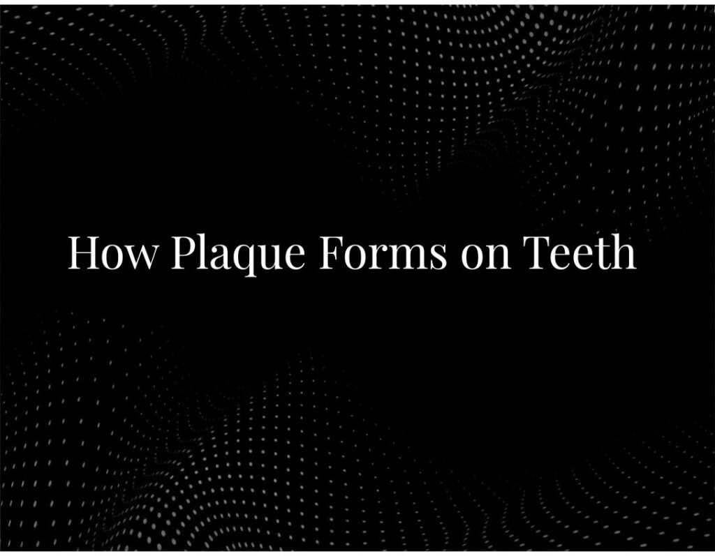 Plaque formation teeth process diagram