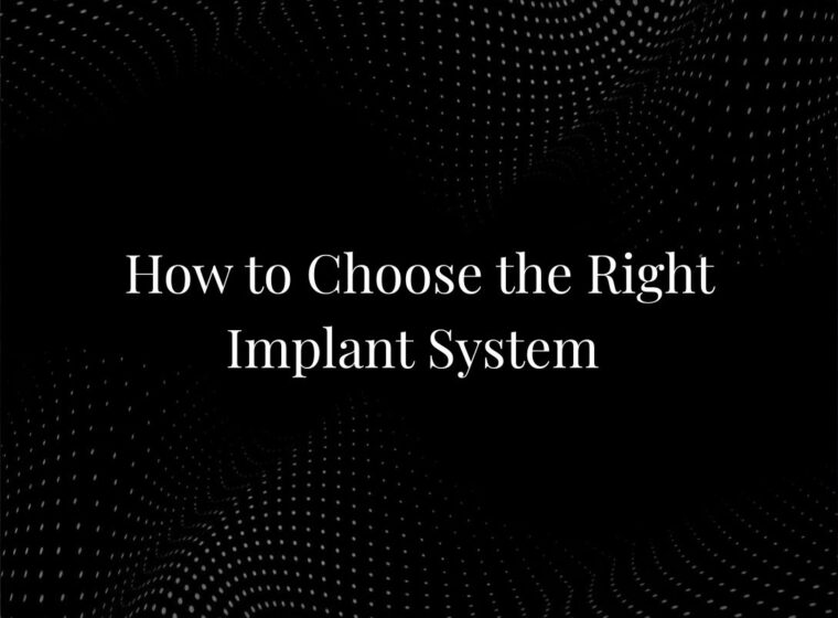 How to Choose the Right Implant System