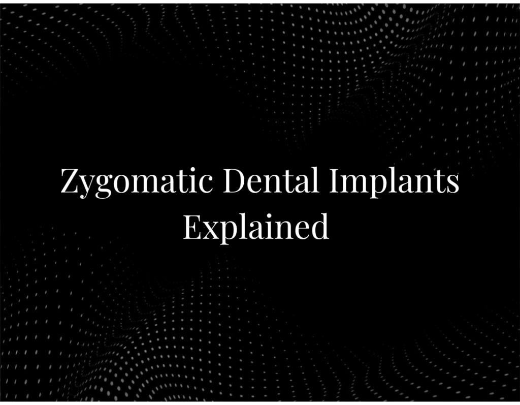 Zygomatic Dental Implants Explained