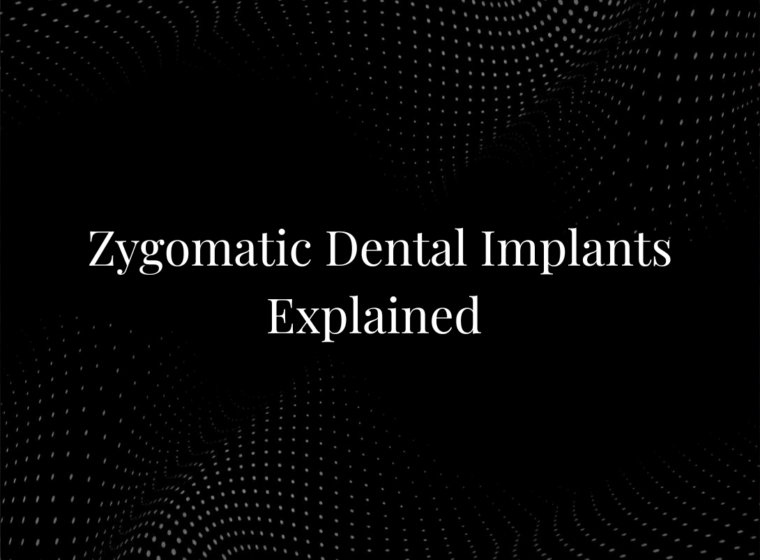 Zygomatic Dental Implants Explained