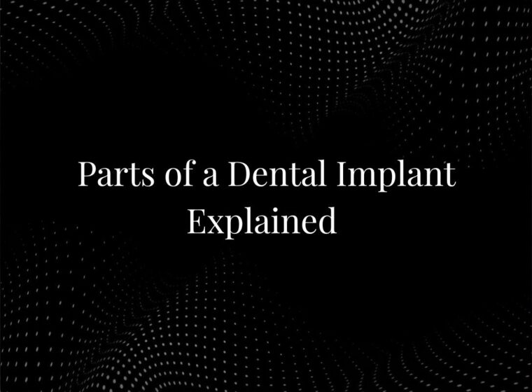 Parts of a Dental Implant Explained