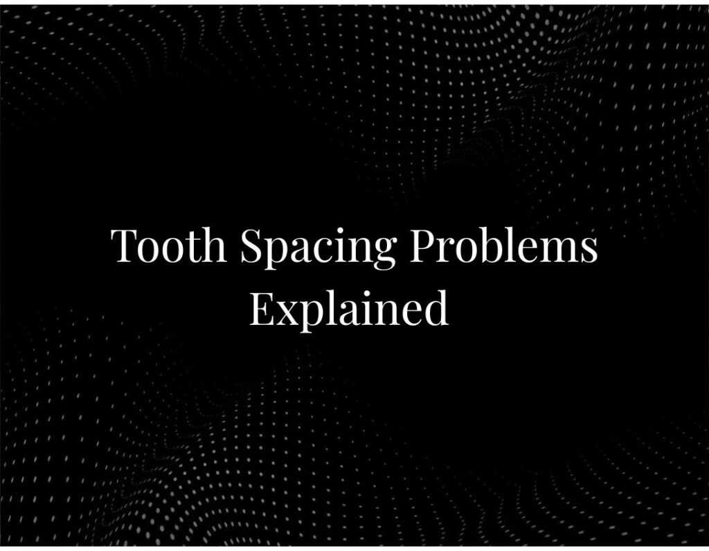 Tooth Spacing Problems Explained