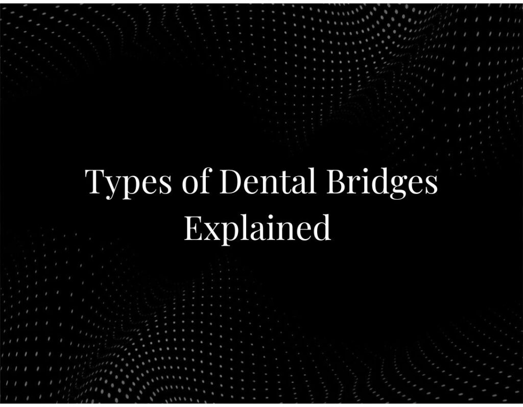 Types of Dental Bridges Explained