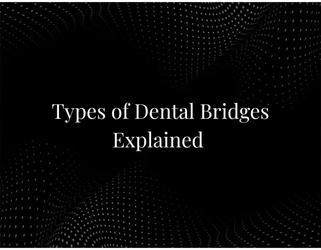 Types of Dental Bridges Explained