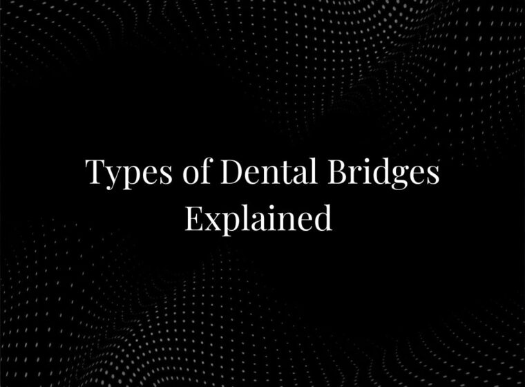 Types of Dental Bridges Explained