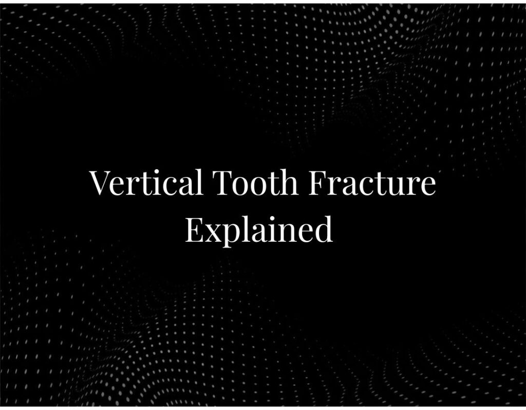 Vertical Tooth Fracture Explained