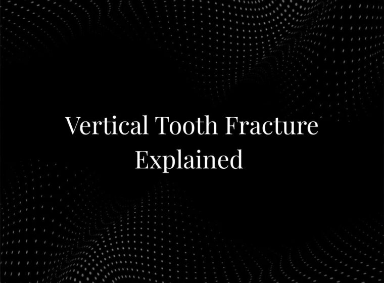 Vertical Tooth Fracture Explained