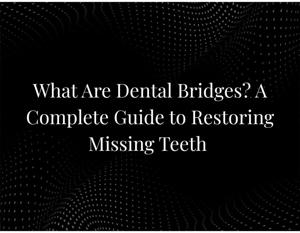 What Are Dental Bridges