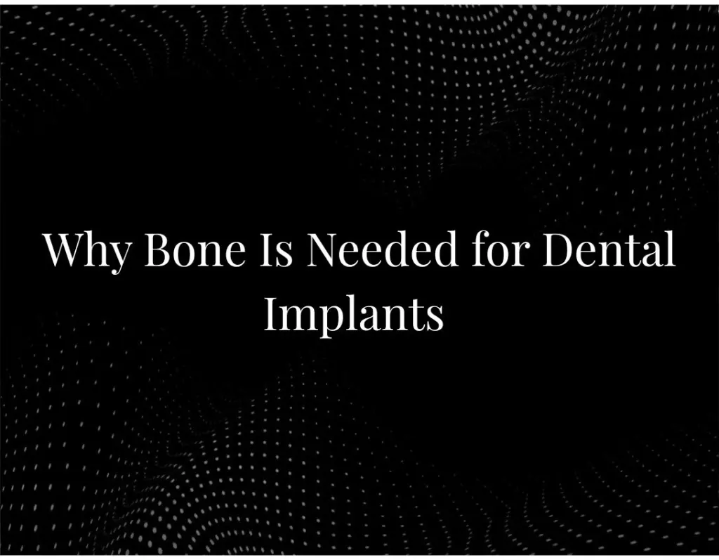 Why Bone Is Needed for Dental Implants
