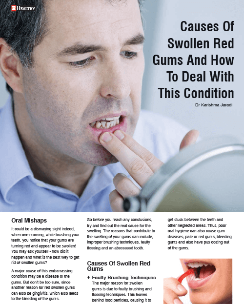 Causes Of Swollen Red Gums And How To Deal With This Condition