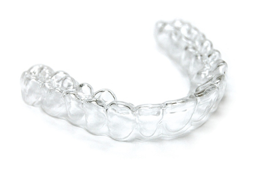 What Are Invisible Braces?